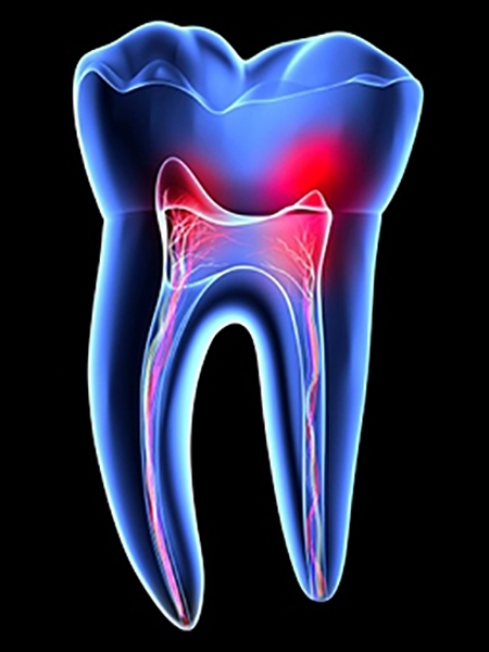 Endodontia
