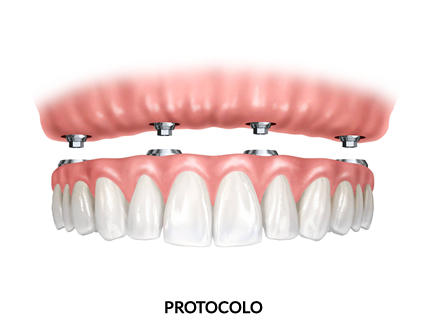 Prótese Dentária